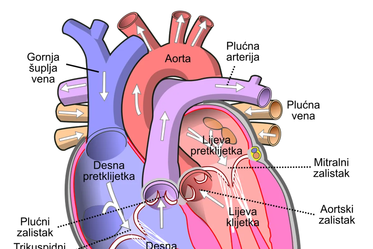Kardiologinja upozorava: Ovo popularno piće moglo bi pridonijeti začepljenju arterija