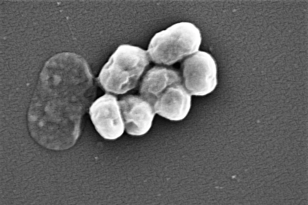 Kućni ljubimci mogući izvor superbakterija otpornih na antibiotike