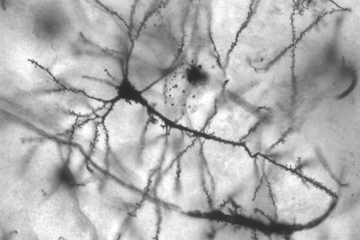 Neurologen über Musiala: Möglicherweise lebenslange Therapie nötig