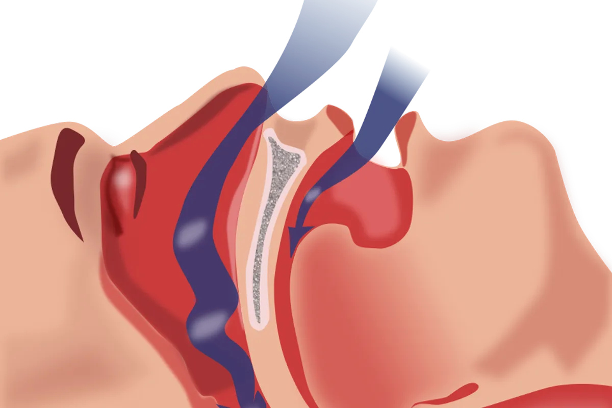 Struggling to Breathe When You Lie Down? These Could Be Signs of a More Serious Condition