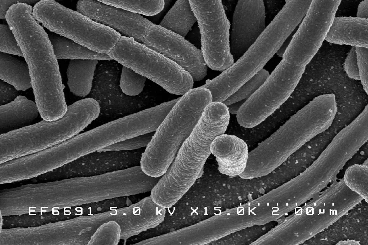 Public Health Institute Rushes to Marex After Pollution Report